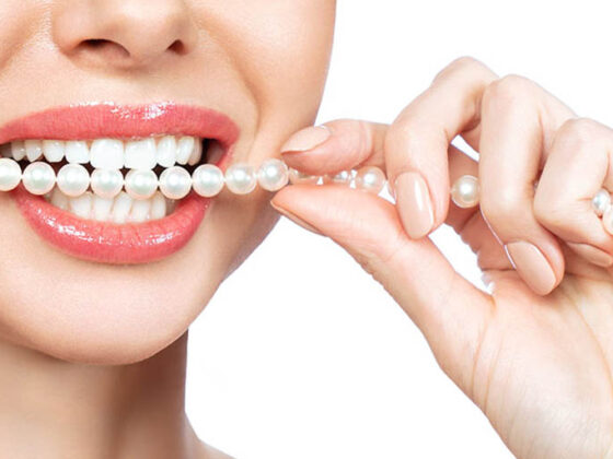 Clínica Dental Naves. Las carillas dentales son una solución perfecta a problemas dentales estéticos leves.