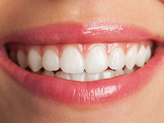 Clínica Dental Naves. Diseño de sonrisa adaptado a las características del paciente