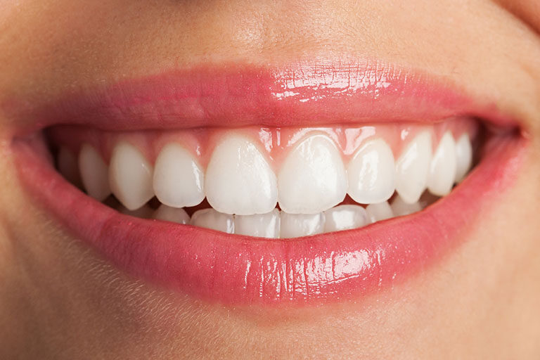 Clínica Dental Naves. Diseño de sonrisa adaptado a las características del paciente