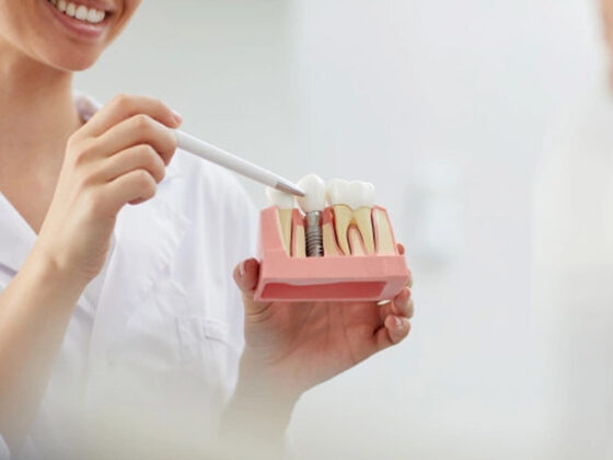 Clínica Dental Zoco Rivas. El injerto de hueso es necesario cuando no se tiene suficiente hueso para un implante dental