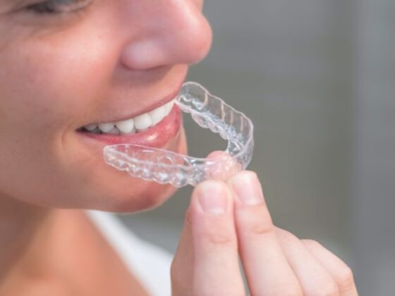 Mejora tu sonrisa con Invisalign - Clínica Dental Naves - Carillas Dentales en Oviedo