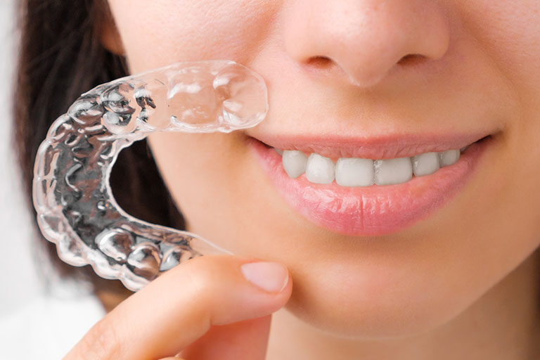 Mejora tu sonrisa con Invisalign en Clínica Dental Naves