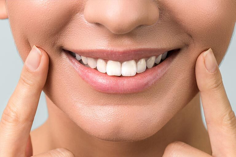 Clínica Dental Naves. Las carillas dentales son la solución ideal para lucir una buena sonrisa en año nuevo
