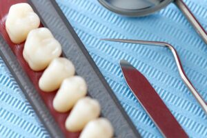 Los implantes dentales no se pueden poner si se tiene una enfermedad de las encías