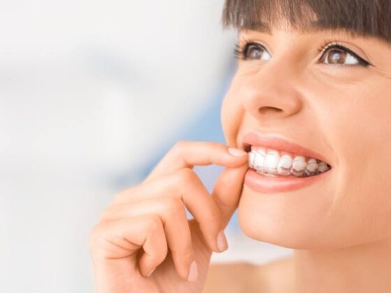 Clínica Dental Naves. Consejos sobre Invisalign que debes conocer.