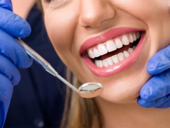 Trucos para un buen mantenimiento de implantes dentales en casa. Clínica Dental Naves. Implantes dentales en Oviedo