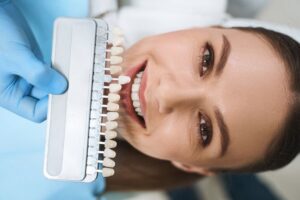 Consejos para cuidar tus carillas dentales